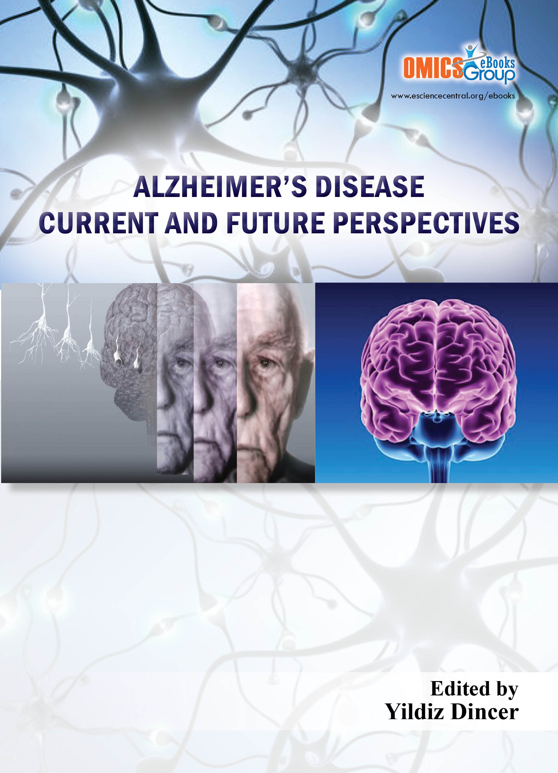 Alzheimers Disease Current and Future Perspectives