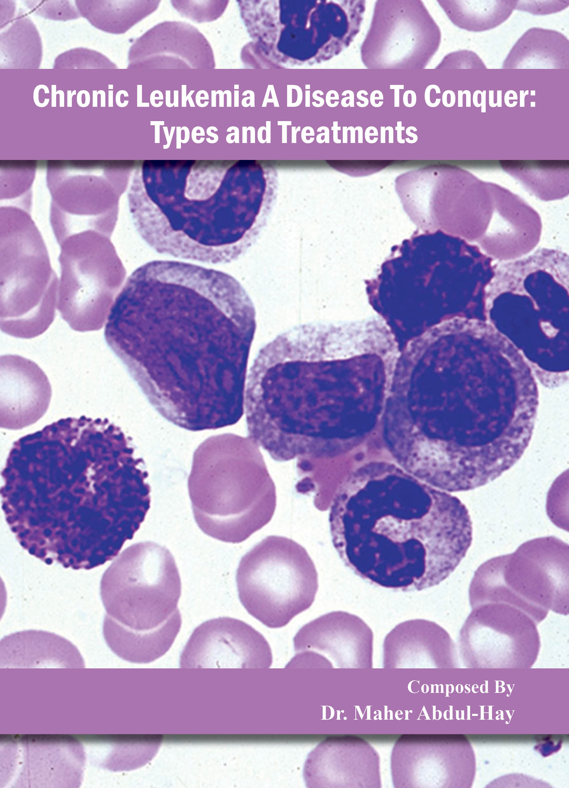 Chronic Leukemia - A Disease to Conquer: Types and Treatments