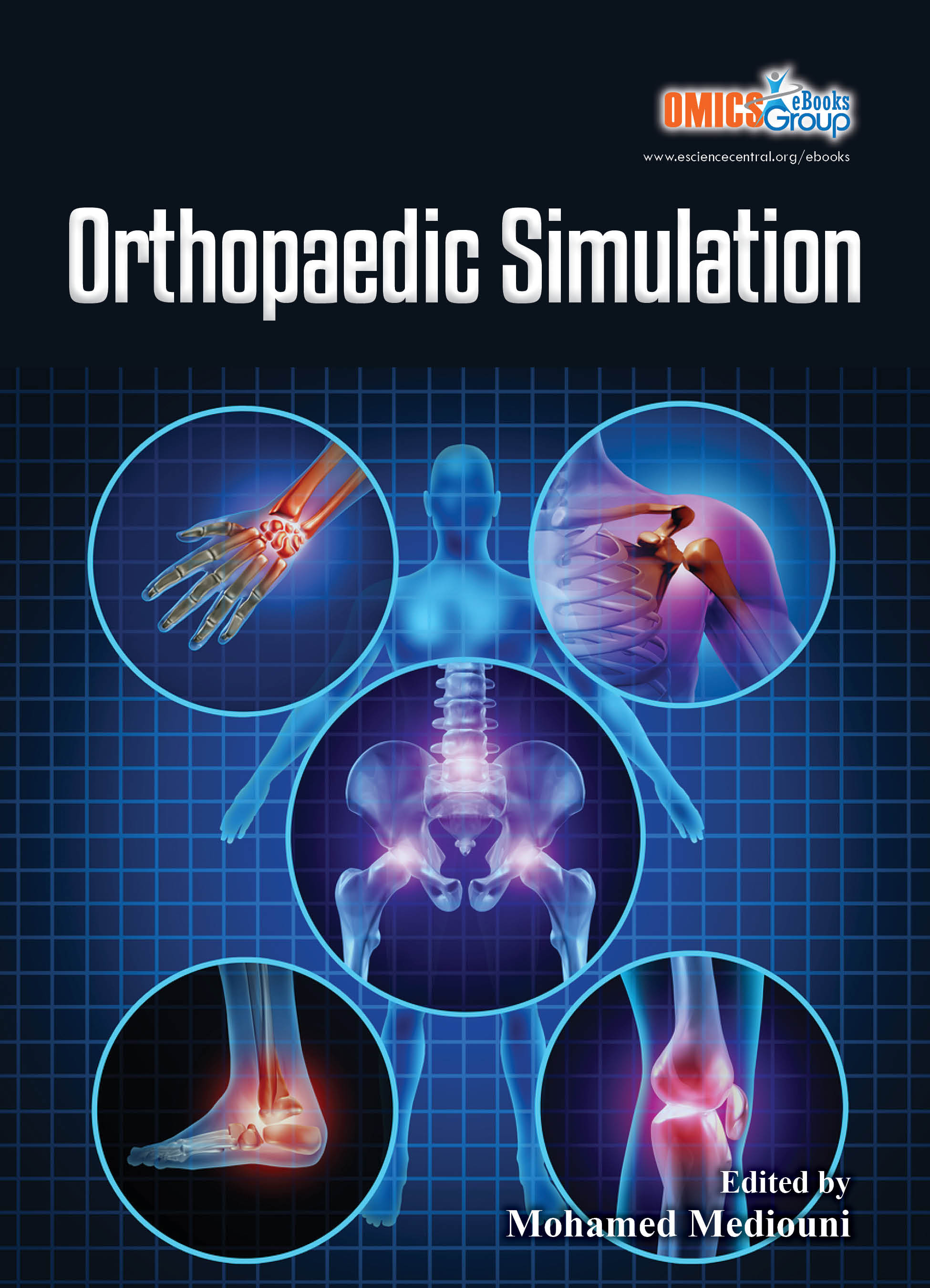 Orthopaedic Simulation