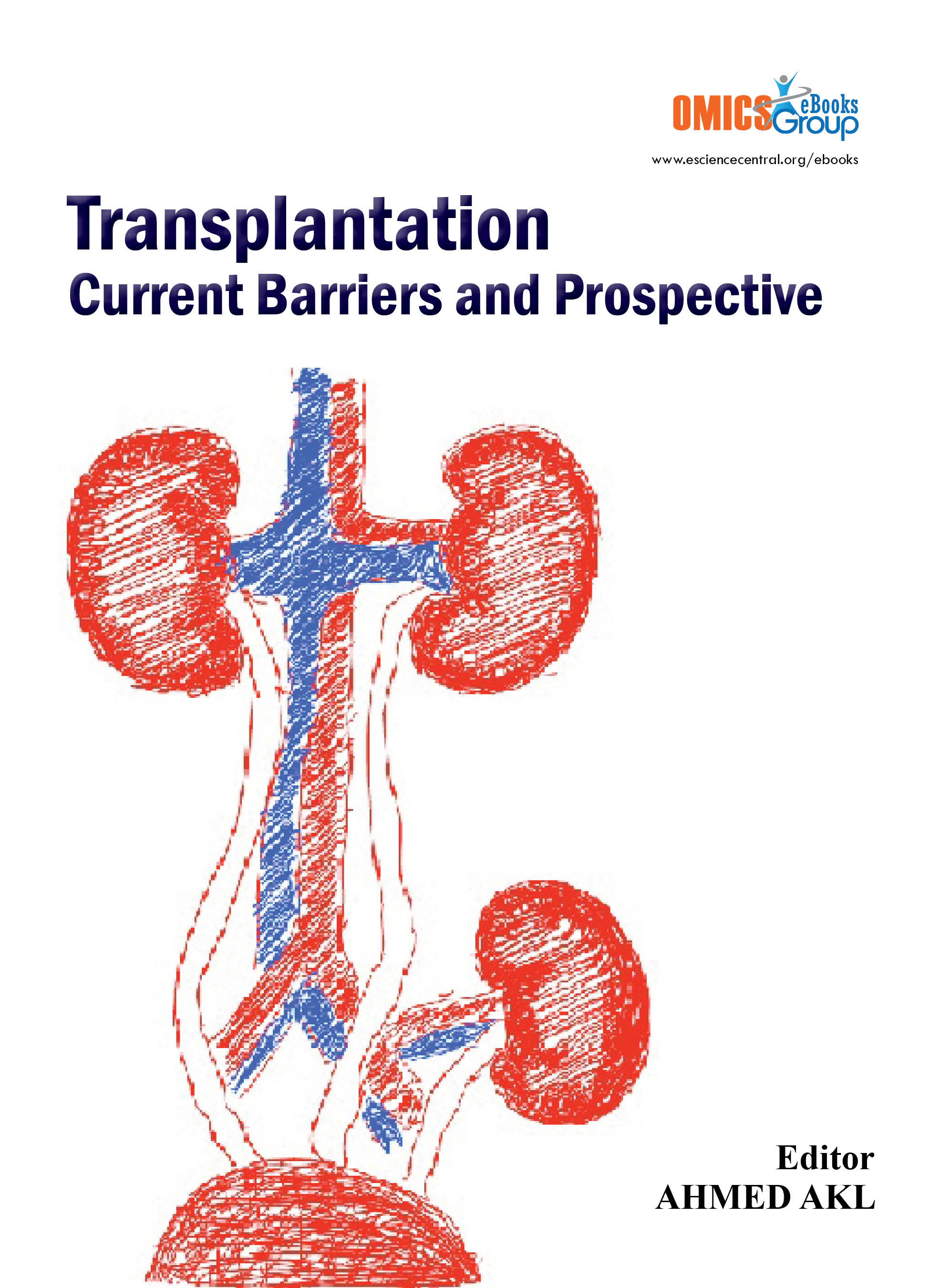 Transplantation Current Barriers And Prospective
