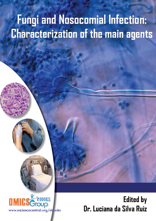 Fungi and Nosocomial Infection: Characterization of the Main Agents