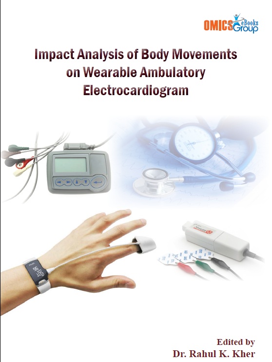 Impact Analysis of Body Movements on Wearable Ambulatory Electrocardiogram