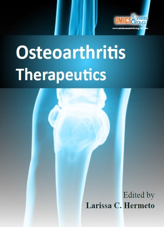Osteoarthritis Therapeutics