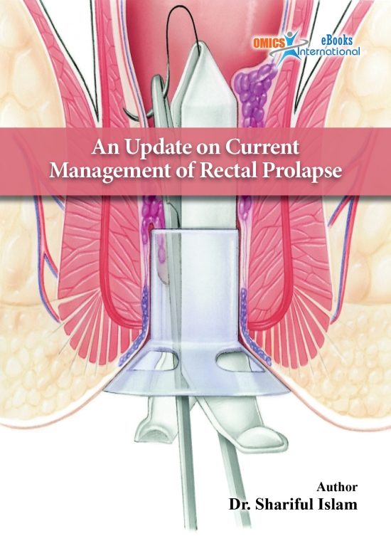 An Update on Current Management of Rectal Prolapse