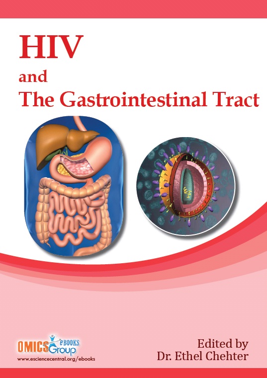 HIV and The Gastrointestinal Tract