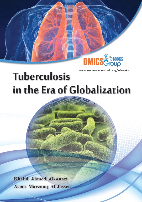 Tuberculosis in the Era of Globalization