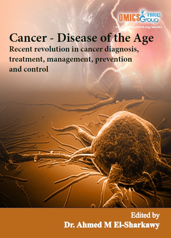 Cancer: Disease of the Age (Recent Revolution in Cancer Diagnosis, Treatment, Management, Prevention and Control)
