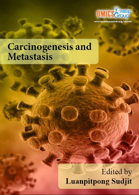 Carcinogenesis and Metastasis