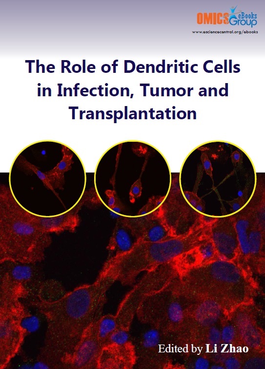 The Role of Dendritic Cells in Infection, Tumor and Transplantation